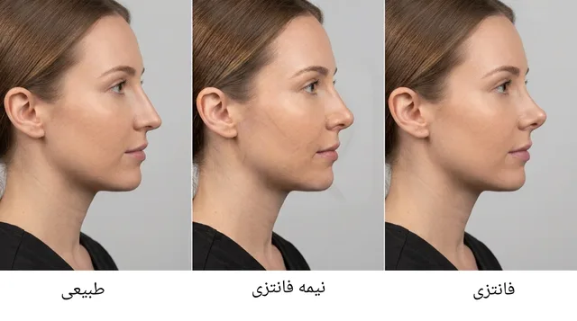 بهترین مدل بینی برای فرم صورت شما؛ بینی طبیعی، نیمه فانتزی یا فانتزی؟